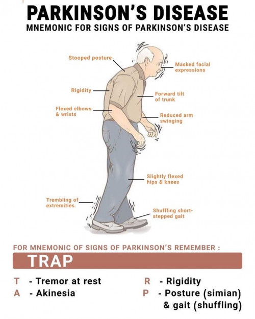 Parkinson hastalığı