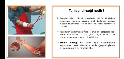 Lateral epikondilit