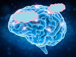 Parkinsonizm - Frontotemporal Demans