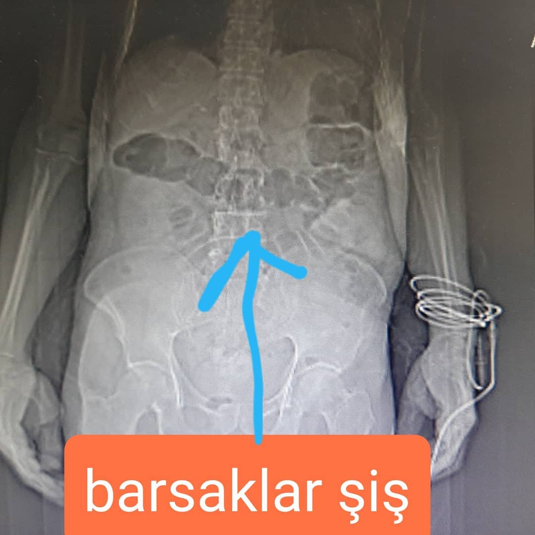 storage.php?o=bx_posts_photos&f=tsbw2di6ws3cfk4jhgmxqvpvijqlf8zh.jpg